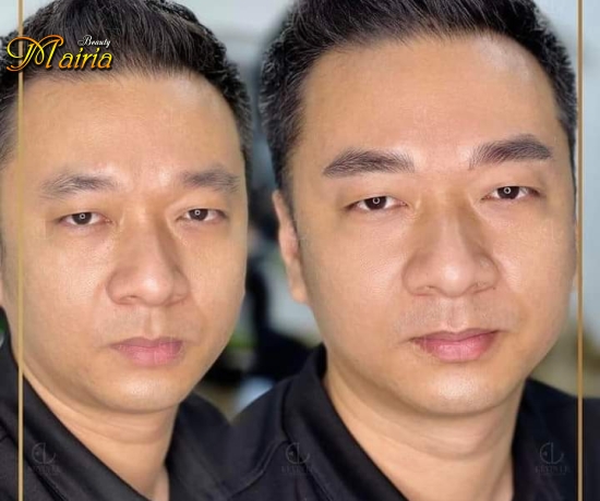Tạo sợi 6D  rõ nét nhất 