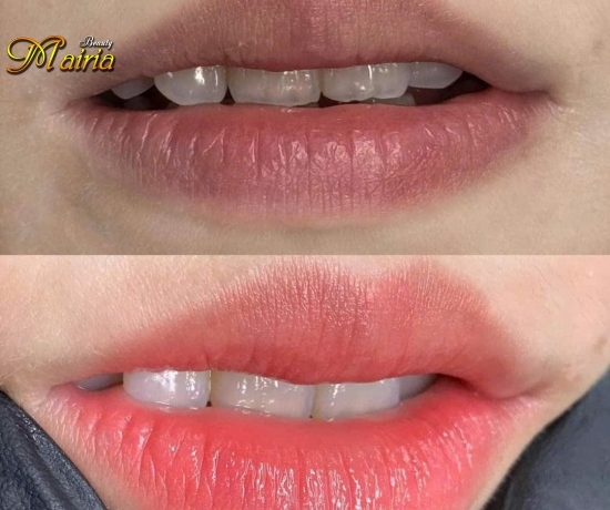 Khử thâm làm hồng môi nam