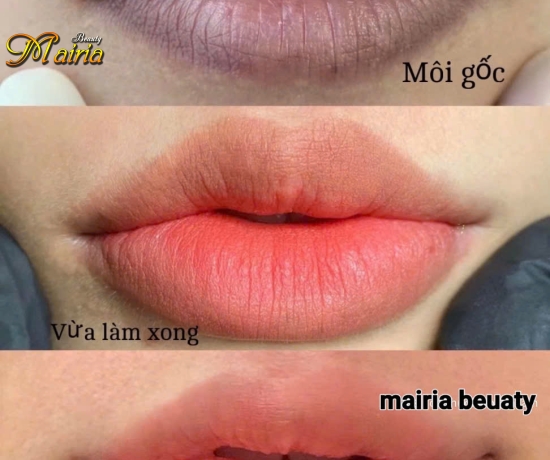 Khử thâm làm hồng môi nam
